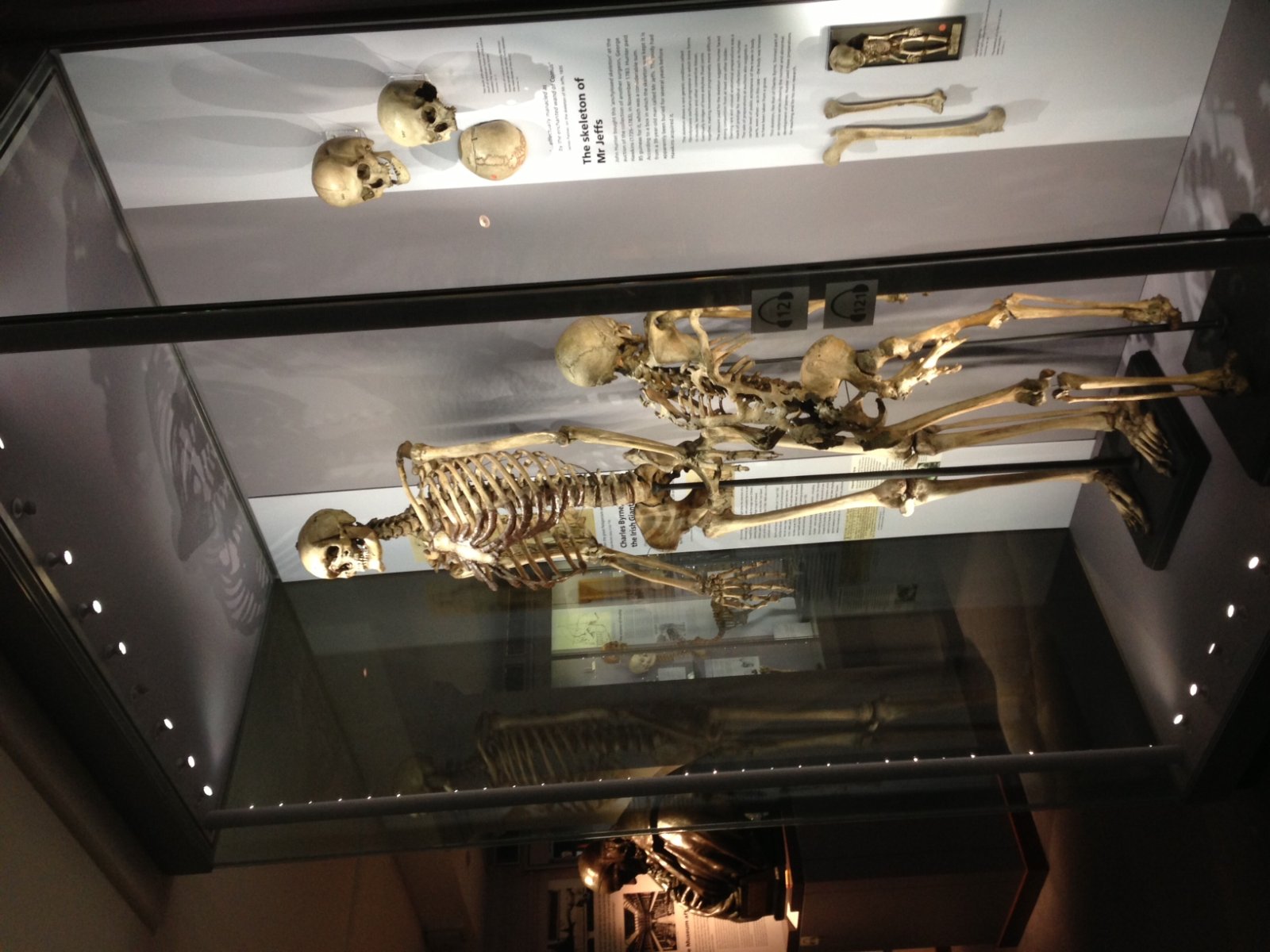 Hunterian Músaem  - 35-43 Lincoln's Inn Fields | Secret World Trip Planner